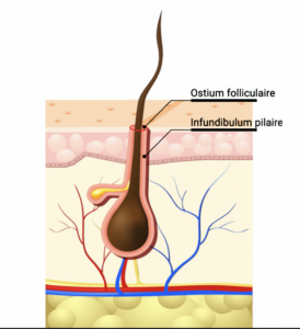 ostium folliculaire